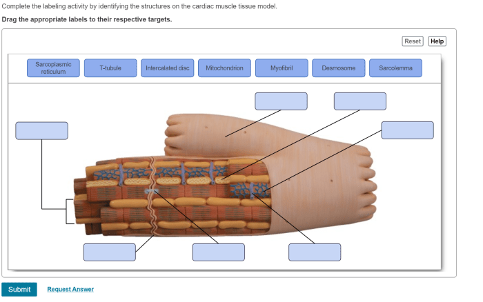 Targets respective cardiac disc intercalated transcribed